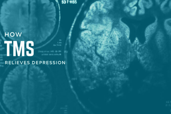 What to Know About TMS Treatment for Depression
